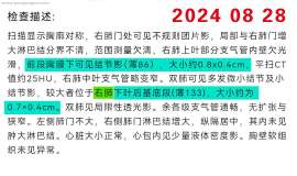 2023.8.29，穿刺取得病理，肺腺癌，2023.9.5，基因检测结果，ALK融合突变。2023.