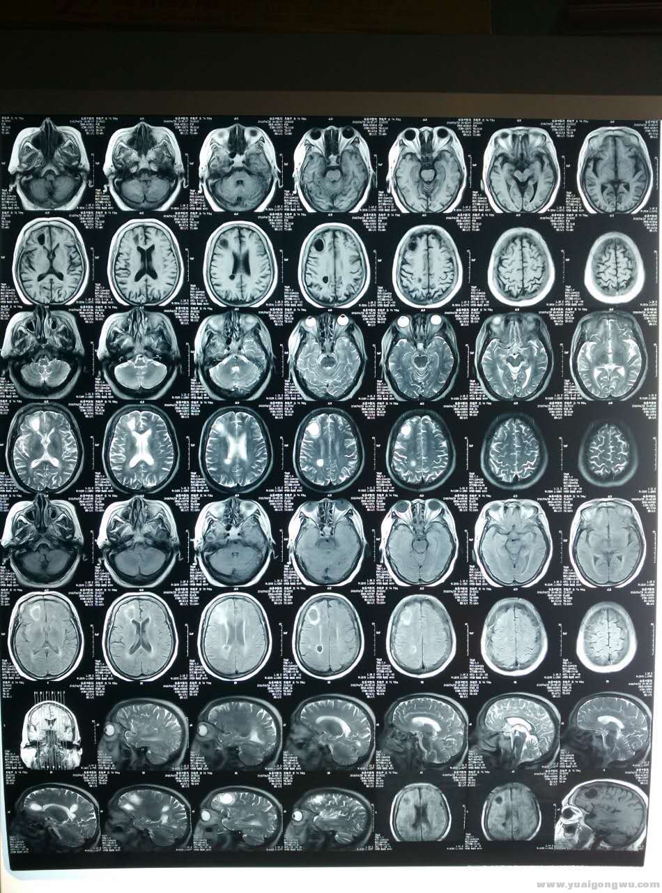 MRI 2016-4-29.jpg