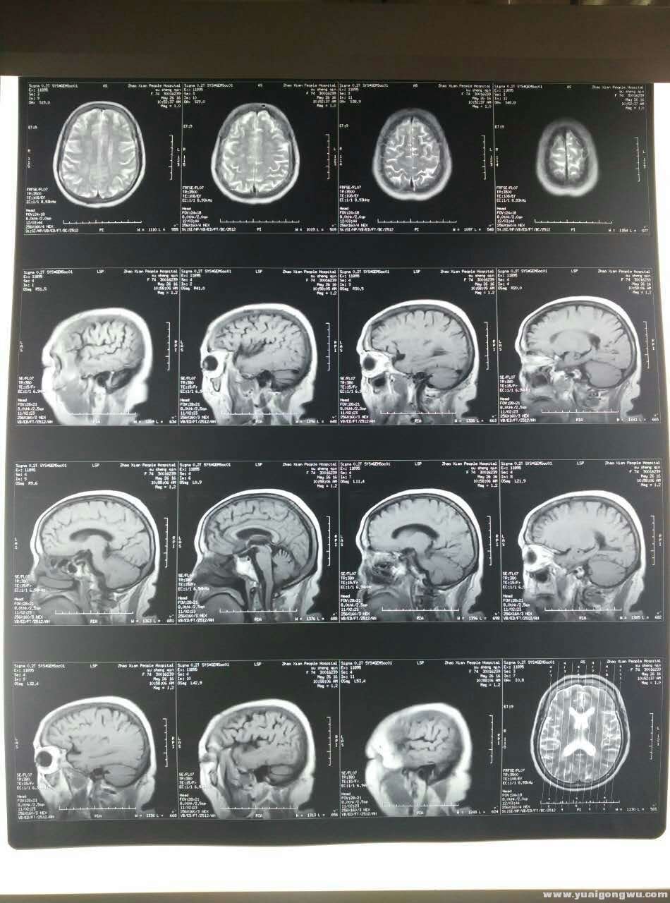 MRI 2016-5-26a.jpg