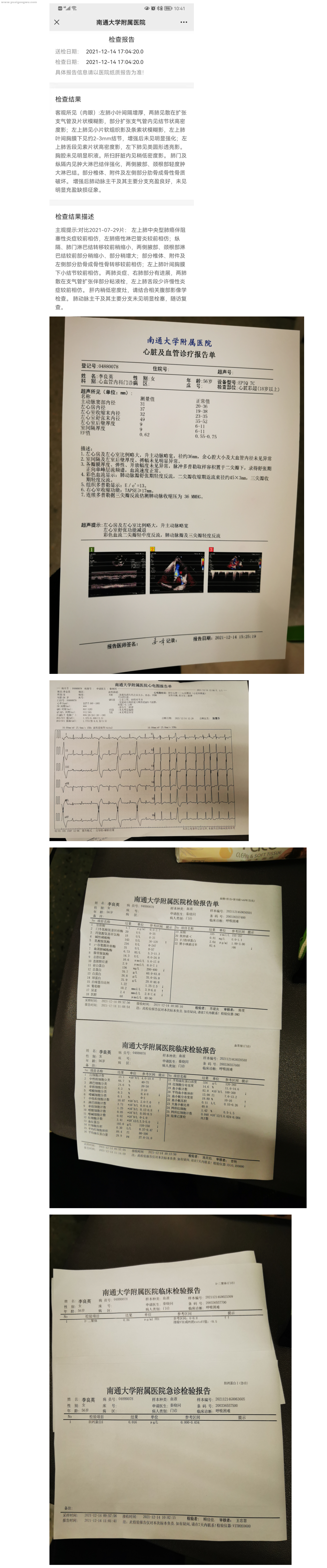 2021.12.14 CT 心电图 心超 血液